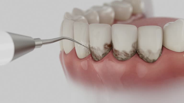 Reliable Dental Implants contractor in Long Beach, NY by Smile Center Dentistry